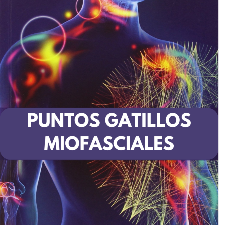 Puntos gatillo miofasciales. Parte ONLINE